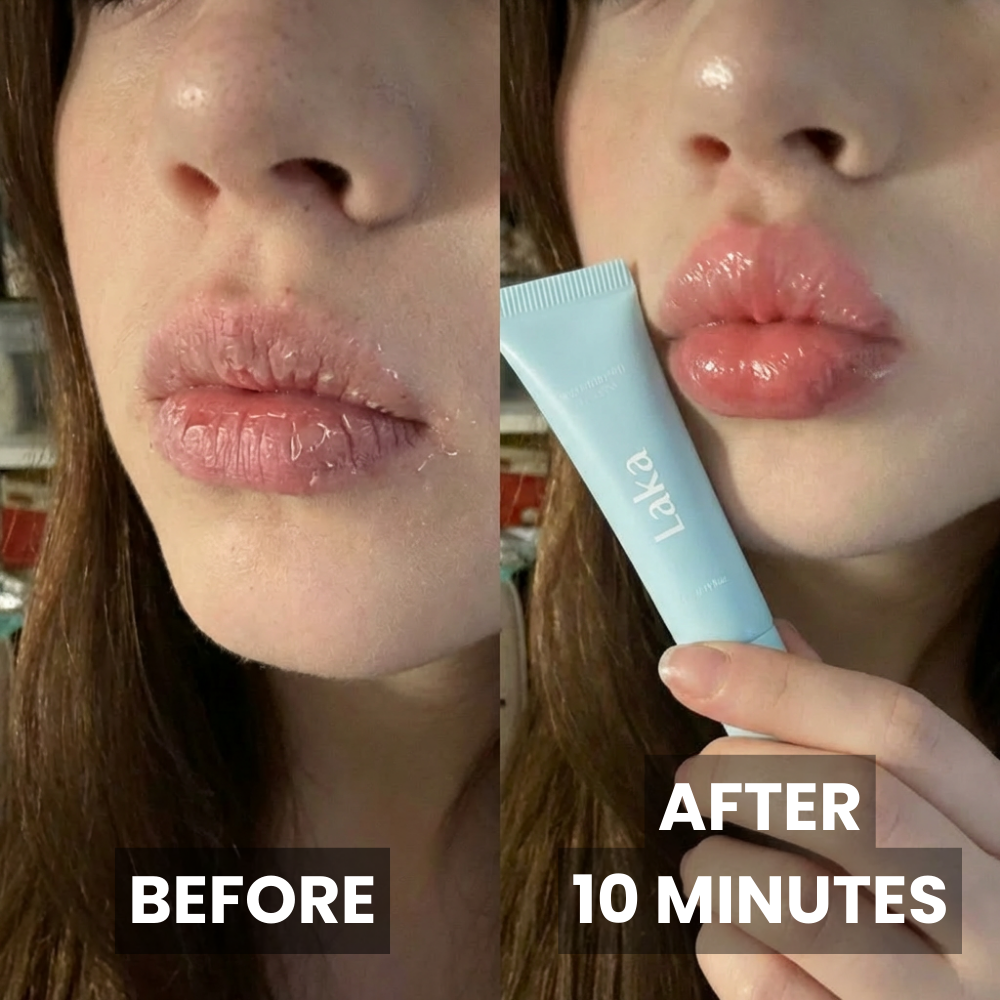 Soothing Prep Lip Mask®