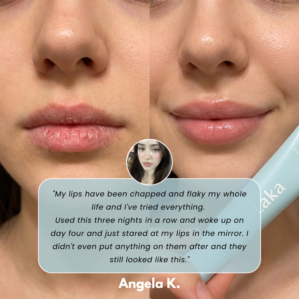 Soothing Prep Lip Mask®