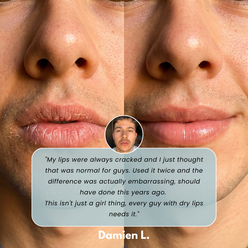 Soothing Prep Lip Mask®